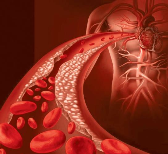 每天壓腿能減輕腳疼 特別是穿高跟鞋的女性！